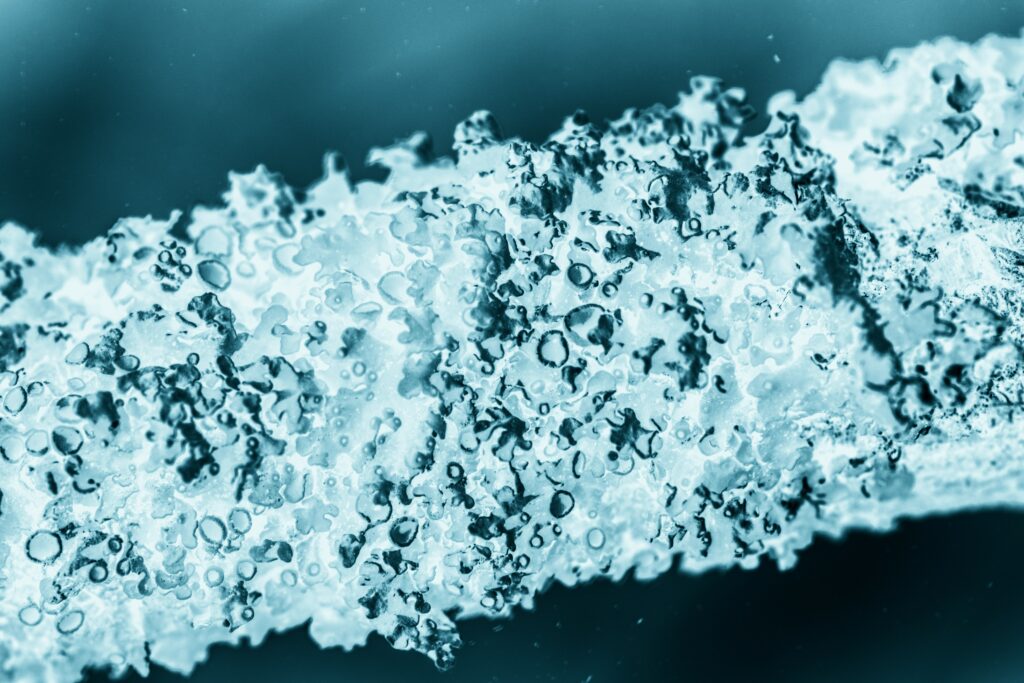 Bactérie légionellose présente dans l'eau